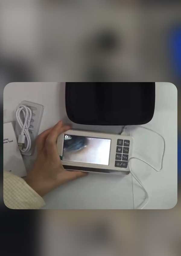 Video Otoskop