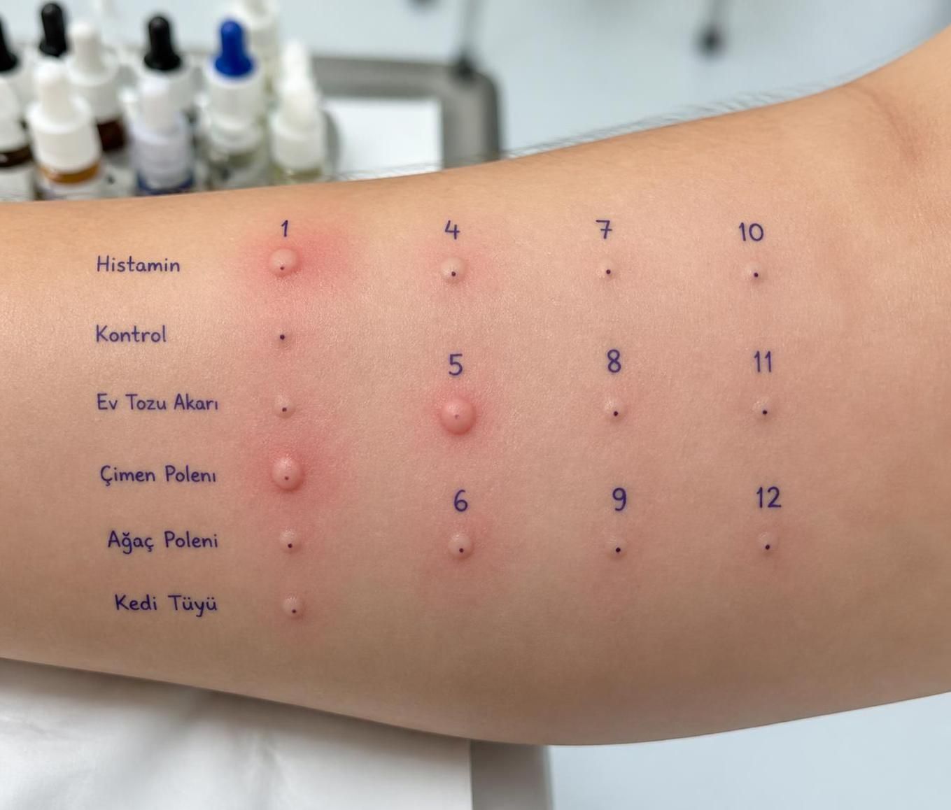 kedi alerjisi belirtileri nelerdir? kedi alerjisinin belirtilerini nasıl anlayacağınızı keşfedin ve doğru önlemleri alın.